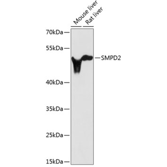 SMPD2 Rabbit Polyclonal Antibody