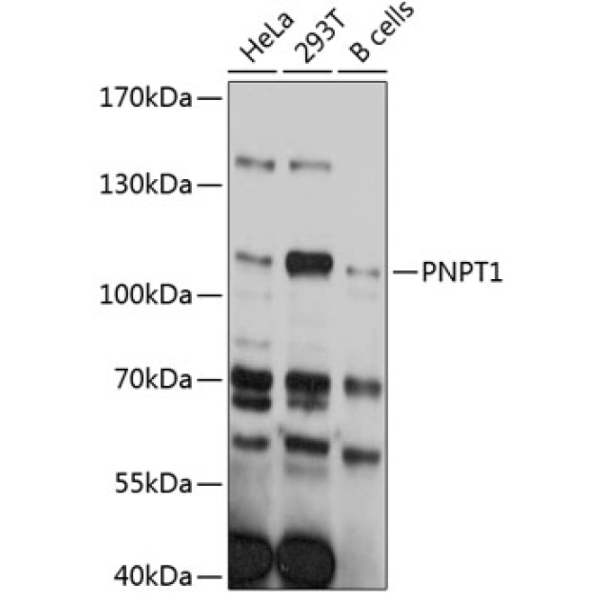 PNPT1 Rabbit Polyclonal Antibody