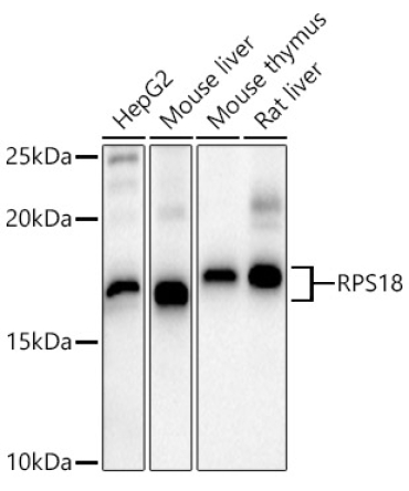 RPS18 Rabbit Polyclonal Antibody