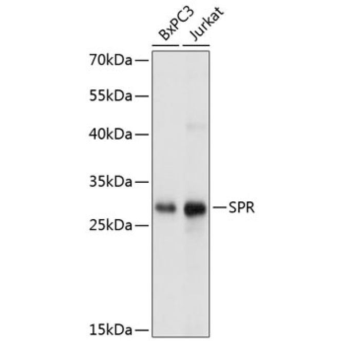 SPR Rabbit Polyclonal Antibody