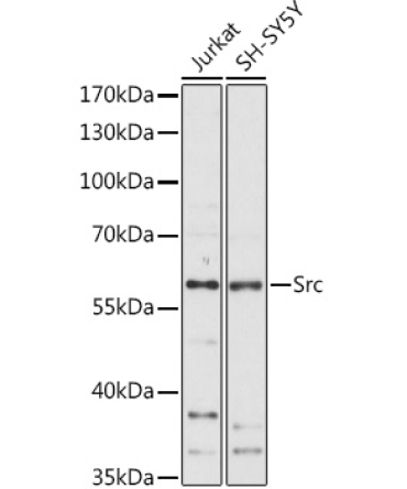 Src Rabbit Polyclonal Antibody