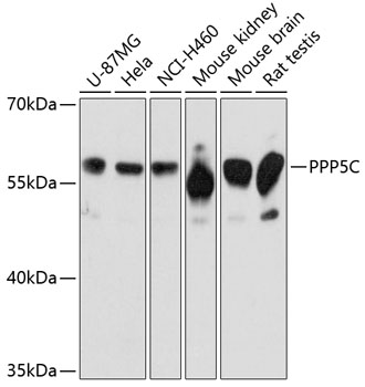 PPP5C Rabbit Polyclonal Antibody