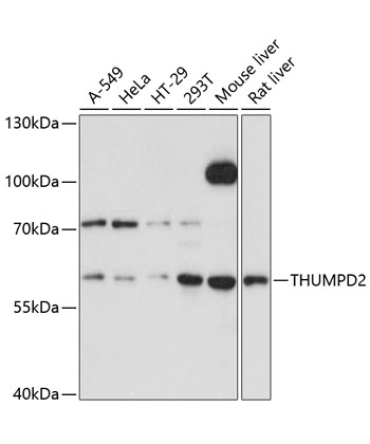 THUMPD2 Rabbit Polyclonal Antibody