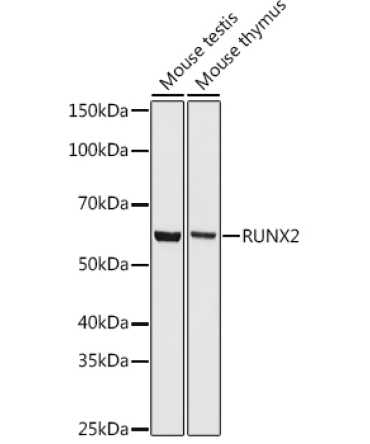 RUNX2 Rabbit Monoclonal Antibody