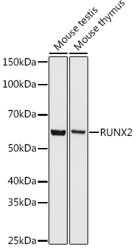 RUNX2 Rabbit Monoclonal Antibody