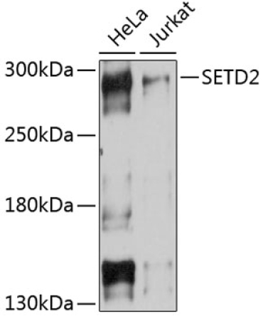 SETD2 Rabbit Polyclonal Antibody