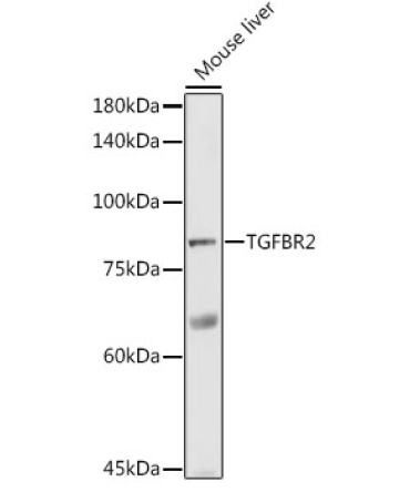 TGF beta Receptor II Rabbit Polyclonal Antibody