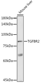 TGF beta Receptor II Rabbit Polyclonal Antibody