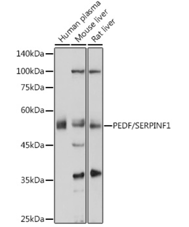 PEDF/SERPINF1 Rabbit Polyclonal Antibody