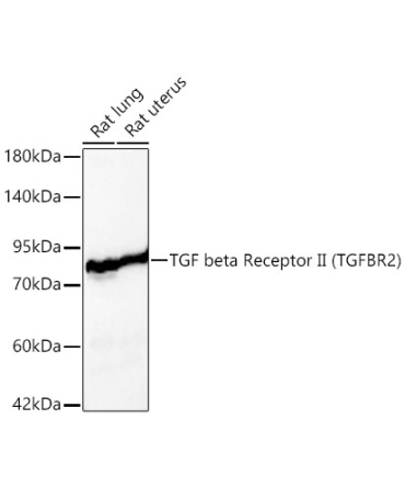 TGF beta Receptor II Rabbit Polyclonal Antibody
