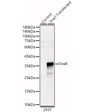 Snail Rabbit Polyclonal Antibody