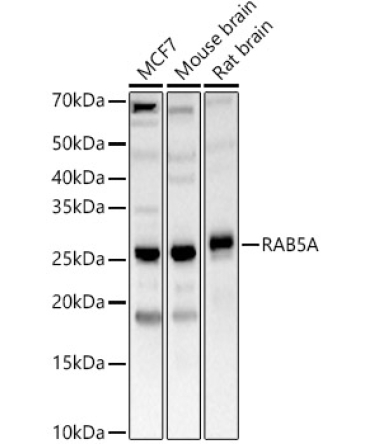 RAB5A Rabbit Polyclonal Antibody