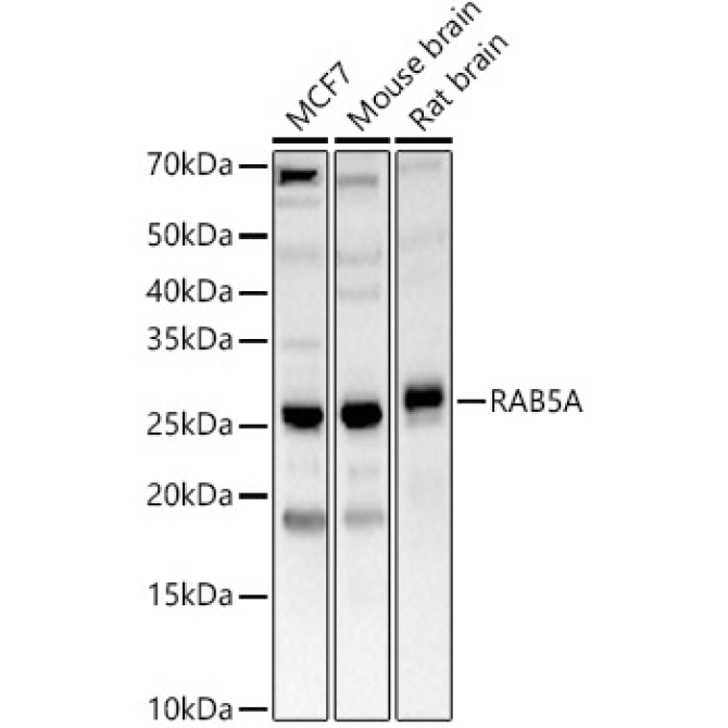 RAB5A Rabbit Polyclonal Antibody