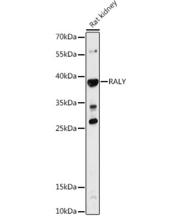 RALY Rabbit Polyclonal Antibody