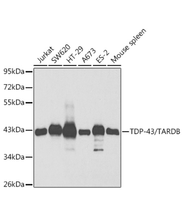 TDP-43/TARDBP Rabbit Polyclonal Antibody