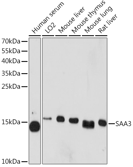 SAA3 Rabbit Polyclonal Antibody