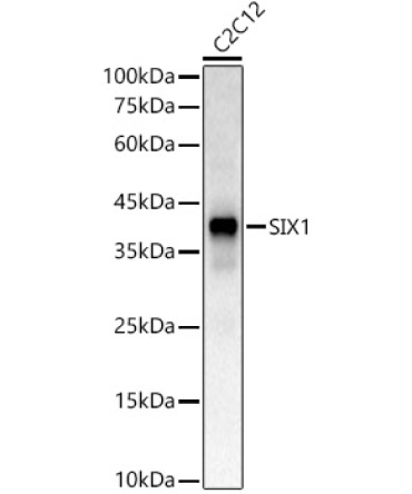 SIX1 Rabbit Polyclonal Antibody