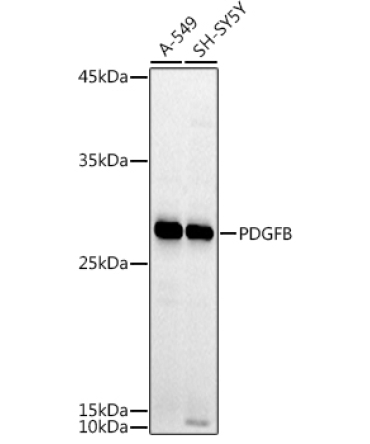 PDGFB Rabbit Polyclonal Antibody