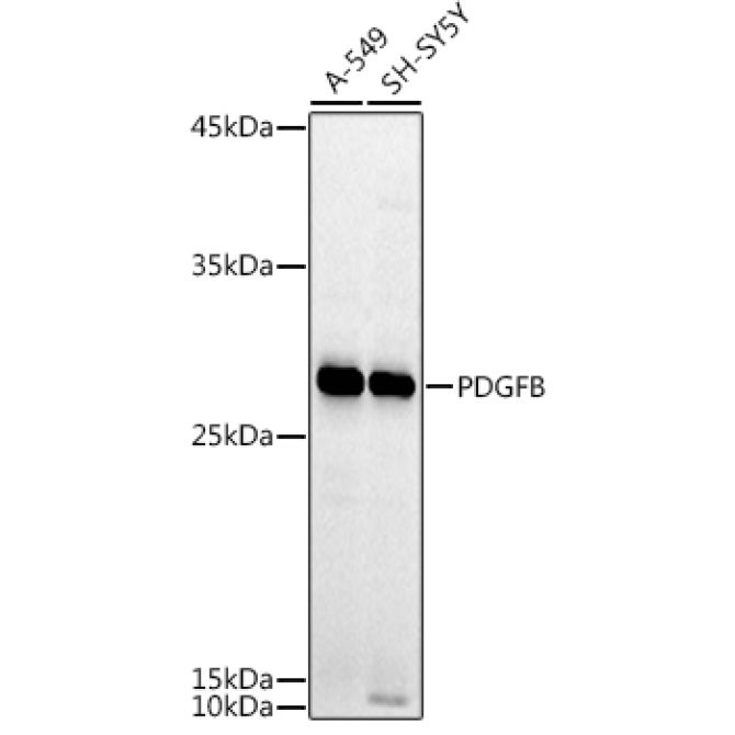 PDGFB Rabbit Polyclonal Antibody