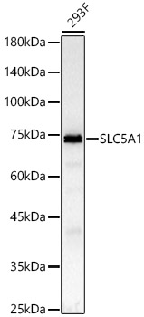 SLC5A1 Rabbit Polyclonal Antibody