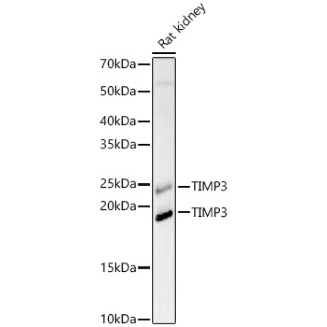 TIMP3 Rabbit Polyclonal Antibody
