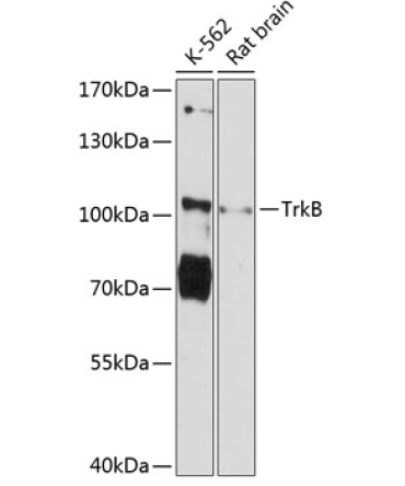 TrkB Rabbit Polyclonal Antibody