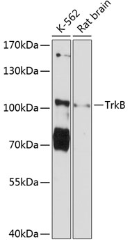 TrkB Rabbit Polyclonal Antibody