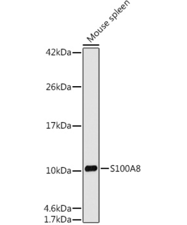 S100A8 Rabbit Monoclonal Antibody
