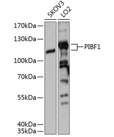PIBF1 Rabbit Polyclonal Antibody