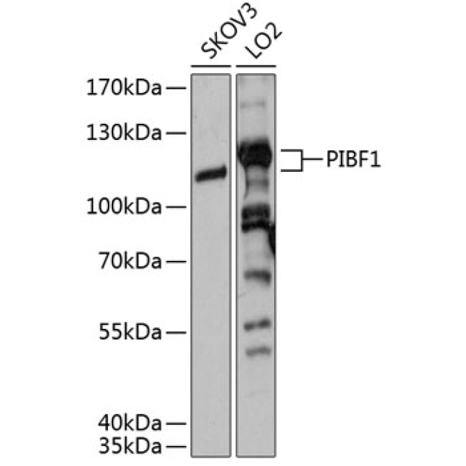 PIBF1 Rabbit Polyclonal Antibody