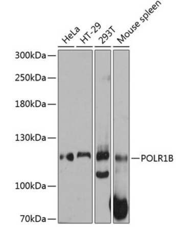 POLR1B Rabbit Polyclonal Antibody