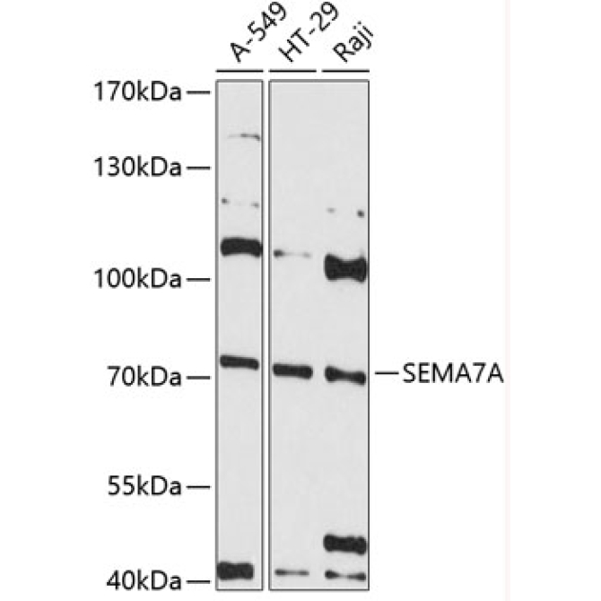 SEMA7A Rabbit Polyclonal Antibody