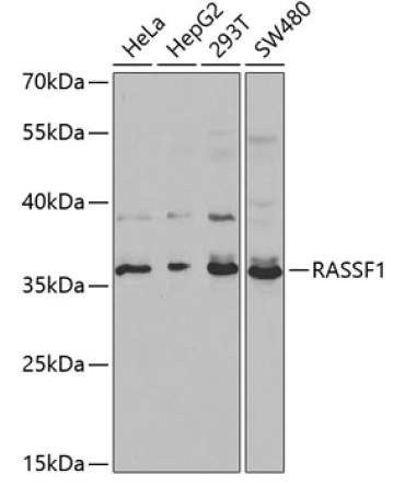 RASSF1 Rabbit Polyclonal Antibody