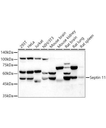 Septin 11 Rabbit Polyclonal Antibody