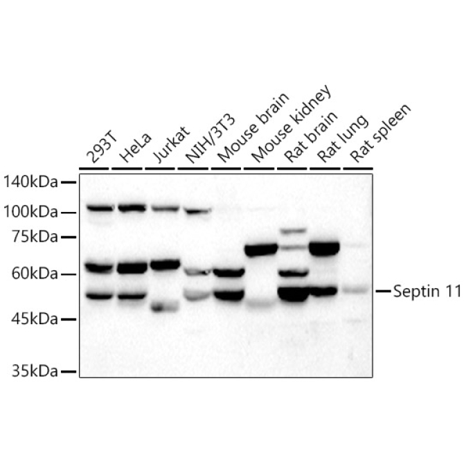 Septin 11 Rabbit Polyclonal Antibody