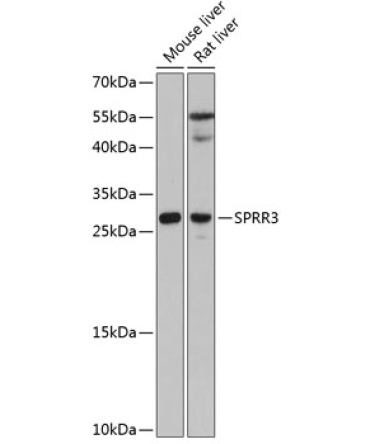 SPRR3 Rabbit Polyclonal Antibody
