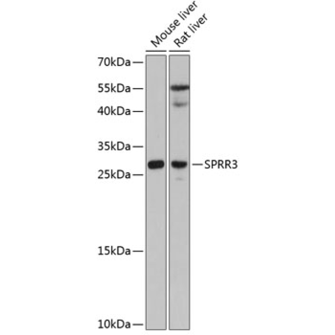 SPRR3 Rabbit Polyclonal Antibody