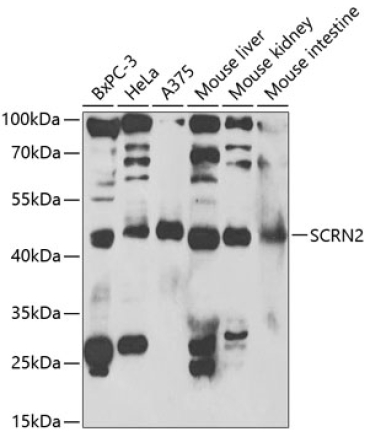 SCRN2 Rabbit Polyclonal Antibody