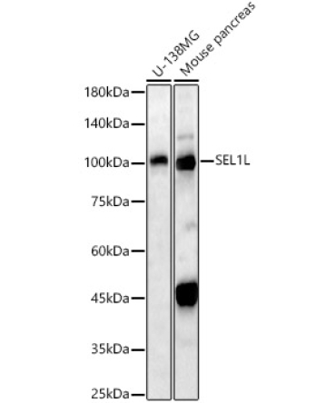 SEL1L Rabbit Polyclonal Antibody