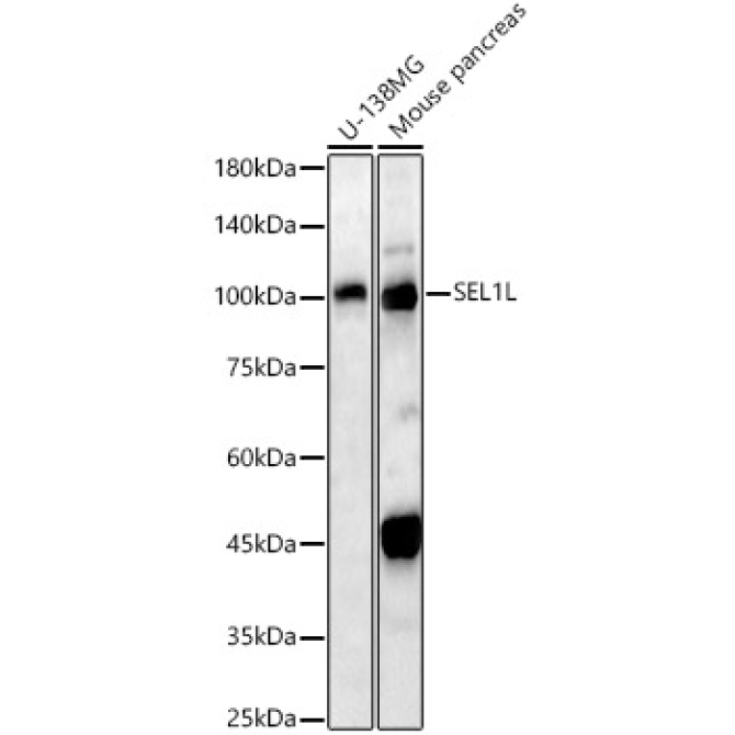 SEL1L Rabbit Polyclonal Antibody