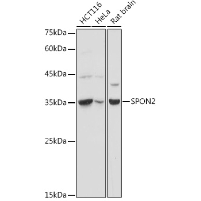 SPON2 Rabbit Polyclonal Antibody