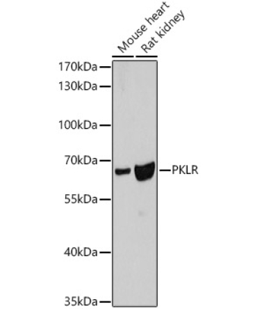 PKLR Rabbit Polyclonal Antibody