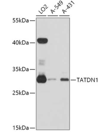 TATDN1 Rabbit Polyclonal Antibody