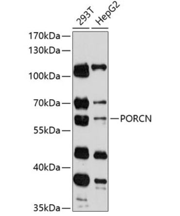 PORCN Rabbit Polyclonal Antibody