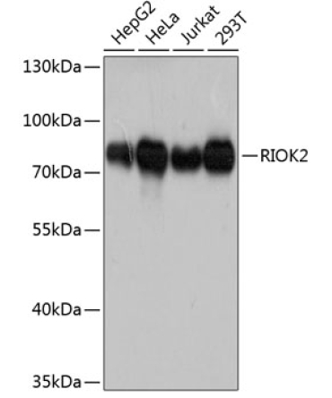 RIOK2 Rabbit Polyclonal Antibody