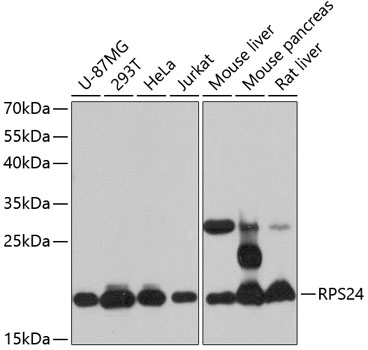 RPS24 Rabbit Polyclonal Antibody