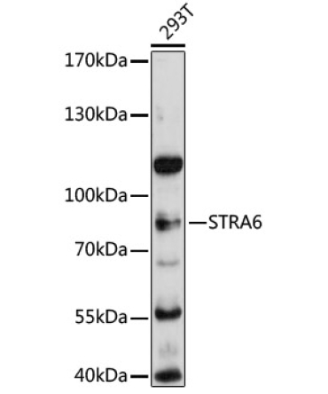 STRA6 Rabbit Polyclonal Antibody