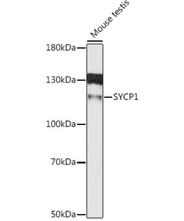 SYCP1 Rabbit Polyclonal Antibody