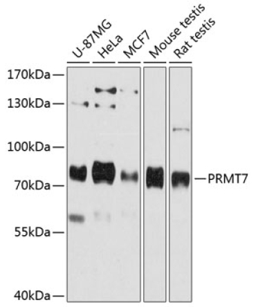 PRMT7 Rabbit Polyclonal Antibody