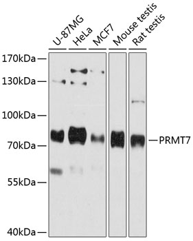 PRMT7 Rabbit Polyclonal Antibody